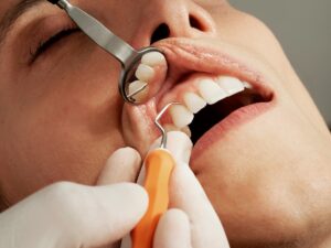 cracked tooth pain in Baton Rouge
