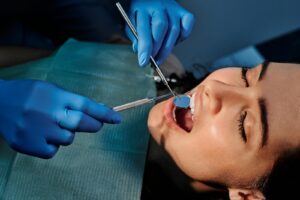 cracked tooth repair in Baton Rouge
